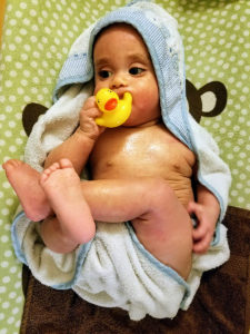 child with eczema after bath begins to heal